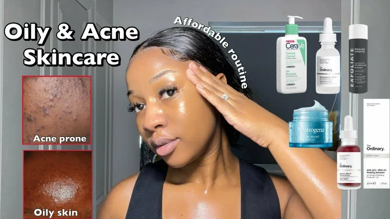 i am a college student. are la roche-posay products better for acne-prone skin than neutrogena?